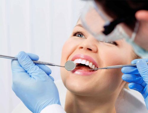 Top 10 Dental Questions You Should Ask