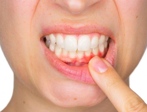 Which Oral Health Symptoms Shouldn’t be Ignored?