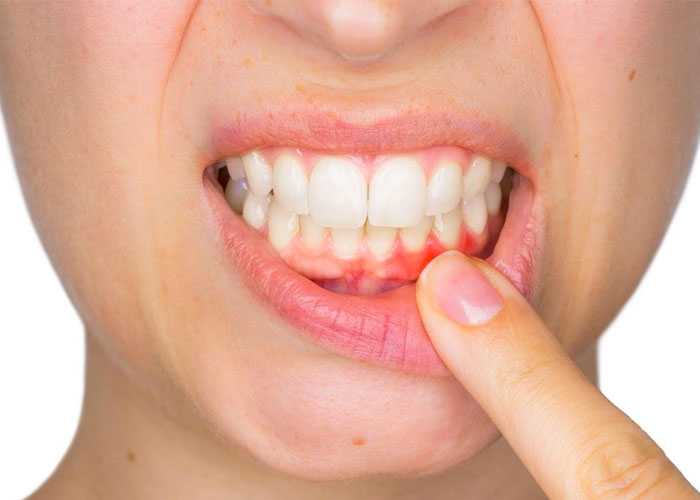 oral health in delta bc