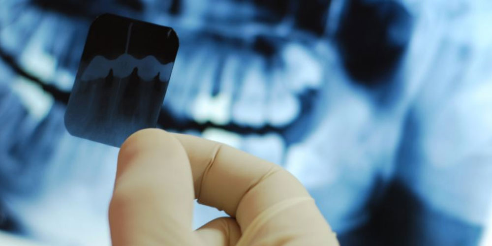 delta dental x rays
