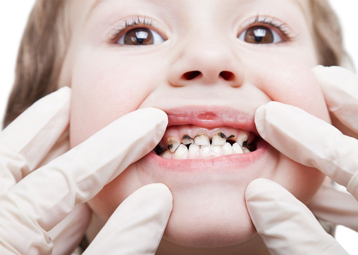 dental facts myths