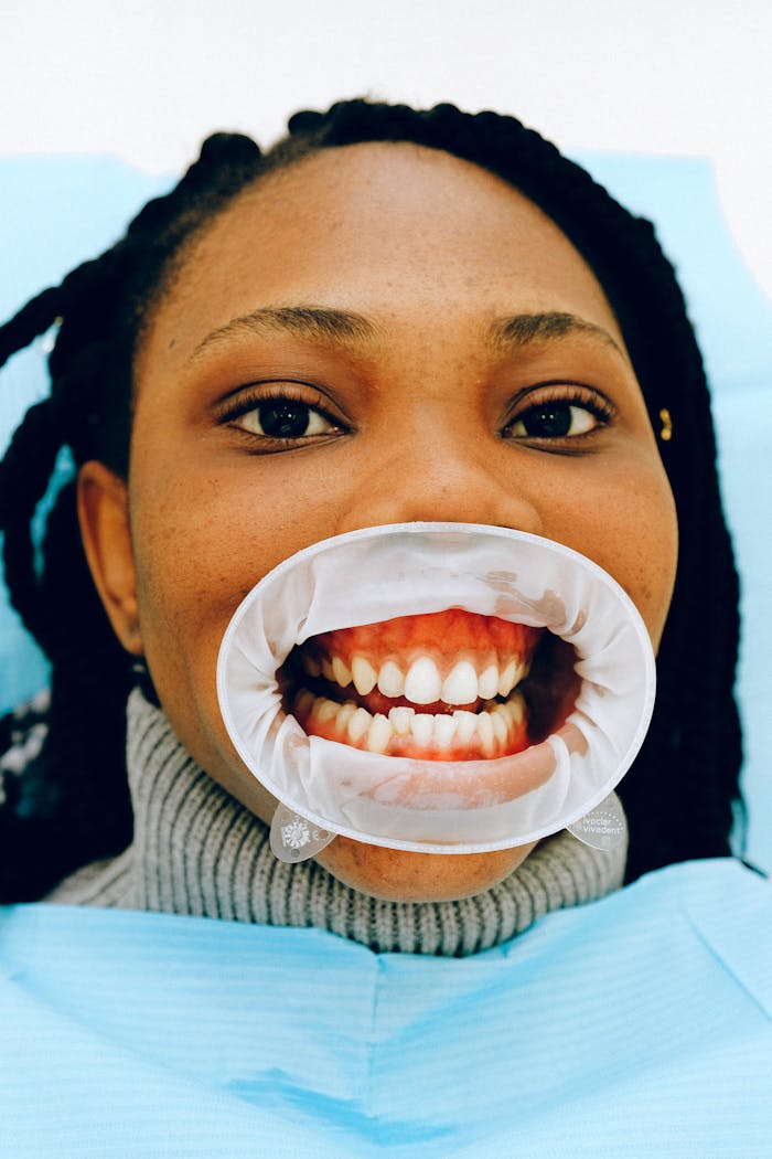 Face of a woman during a dental exam with a mouth expander in a clinic setting.
